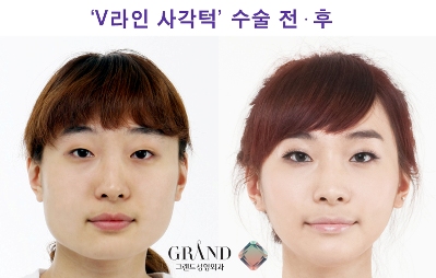 아로미라인 이미지